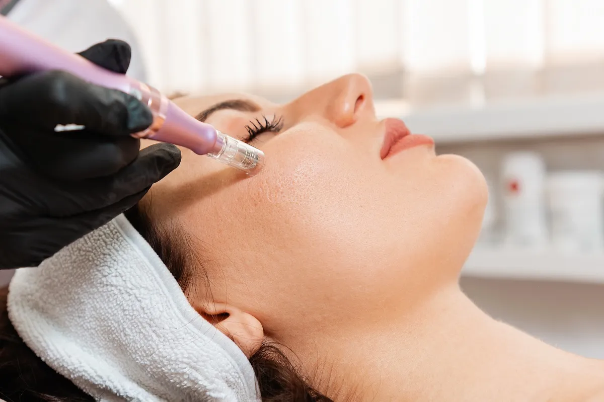 Microneedling in Modesto CA | Aesthetic Lab