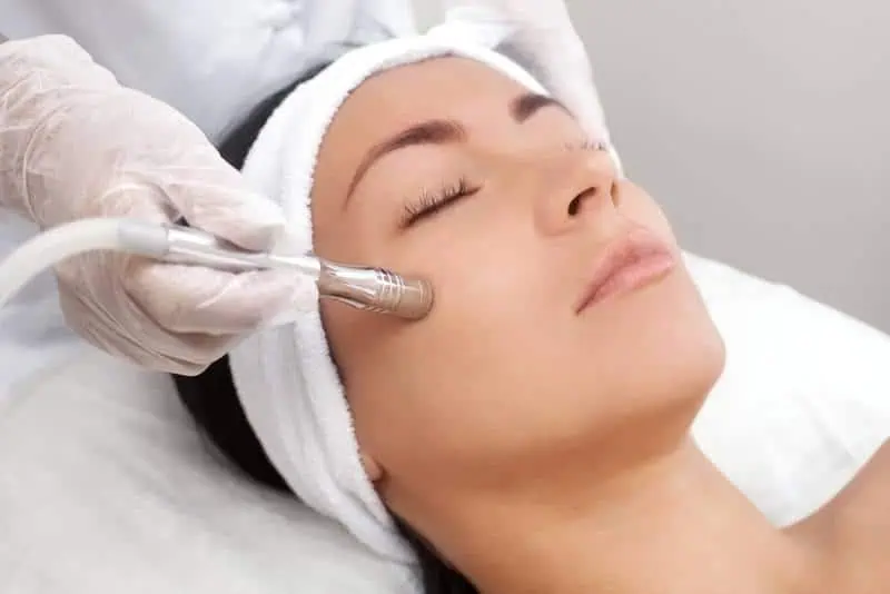 Microneedling