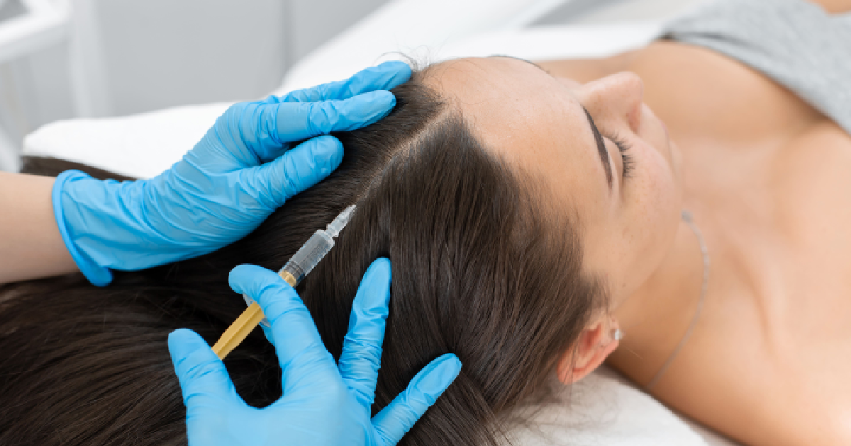 A woman receives a PRP injection into her scalp from a medical professional wearing blue gloves, illustrating non-surgical Hair Restoration in Modesto CA.