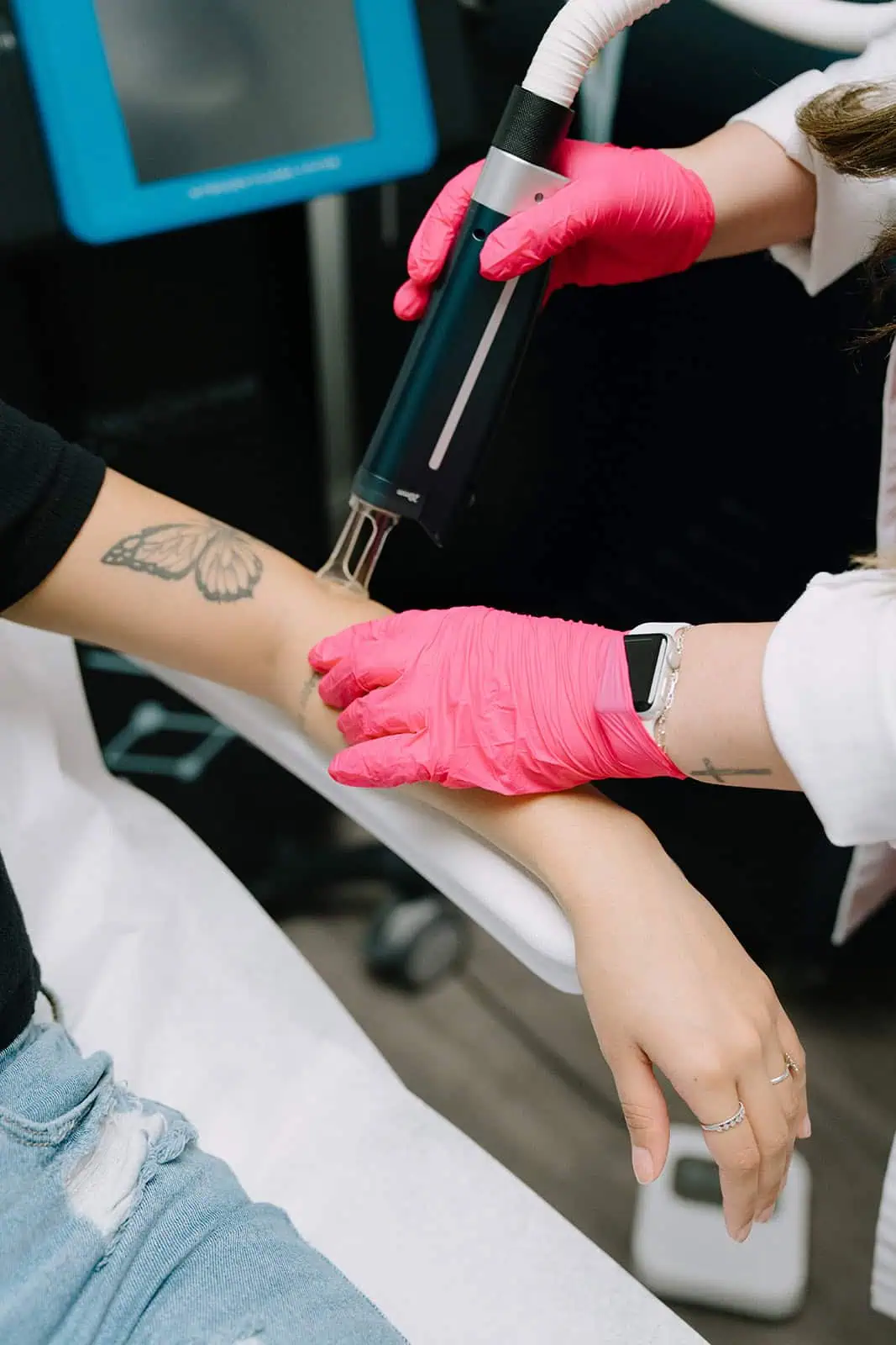 Client receiving tattoo removal in Modesto, Turlock, Stockton, CA at Aesthetic Lab