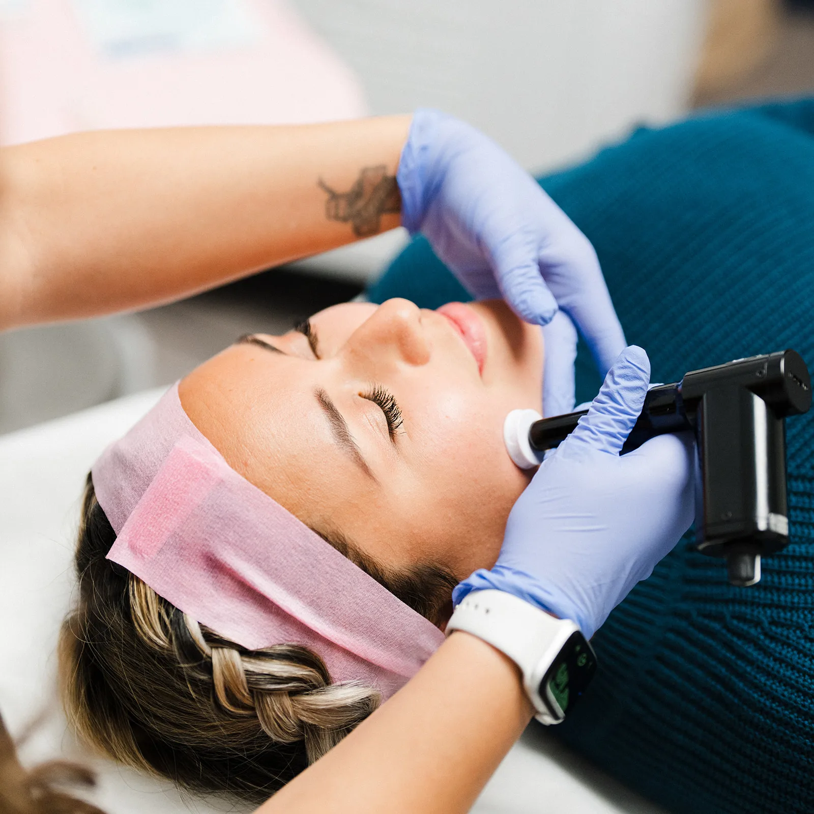 Client receiving Laser services in Modesto, Turlock, Stockton, CA at Aesthetic Lab