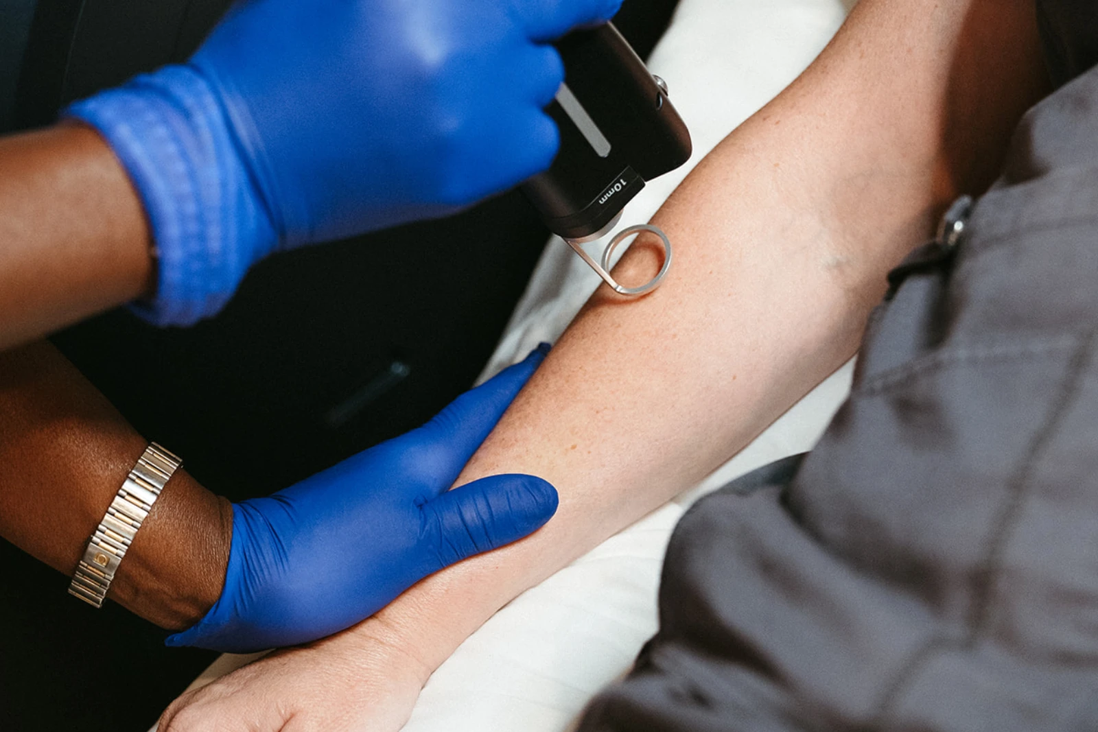 Client receiving tattoo removal in Modesto, Turlock, Stockton, CA at Aesthetic Lab