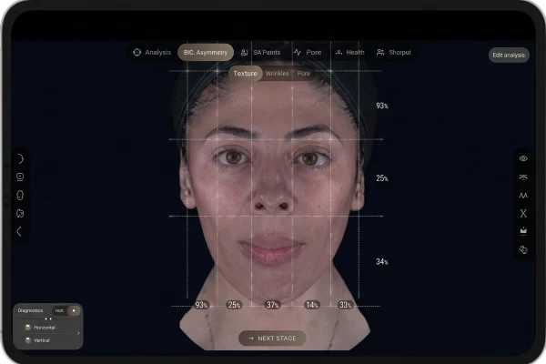 Aura Skin Assessment in Modesto, Turlock, Stockton, CA at Aesthetic Lab