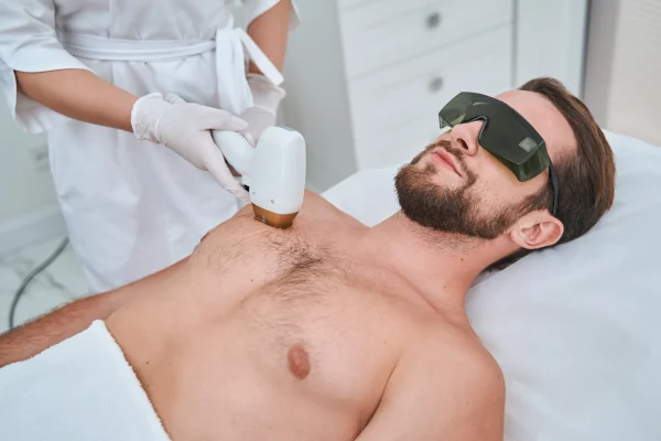Patient wearing safety goggles undergoing a laser hair removal procedure in Modesto, CA.
